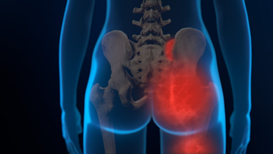 Chronic Sacroiliac Joint Dysfunction